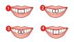 Teeth-shape-test.jpg
