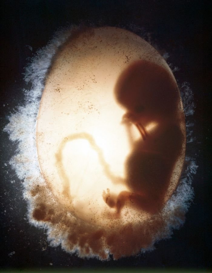 Galerija života: fascinantne fotografije fetusa koje najavljuju magiju rođenja