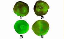 Mrlje za test ličnosti