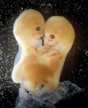 Galerija života: fascinantne fotografije fetusa koje najavljuju magiju rođenja