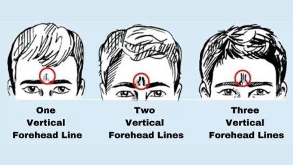 forehead-lines-personality-test.jpg