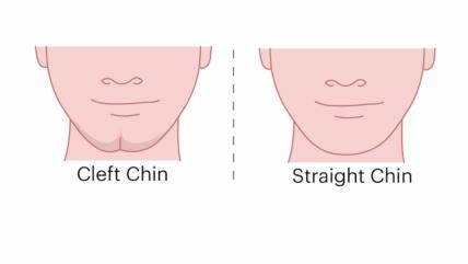 chin-personality-test.jpg