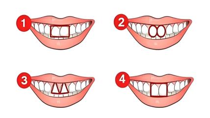Teeth-shape-test.jpg